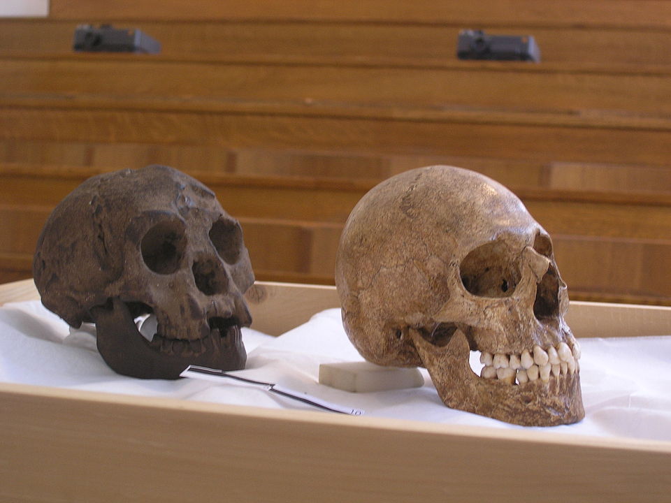 Porównanie odlewu czaszki Homo floresiensis z czaszką człowieka cierpiącego na mikrocefalię.